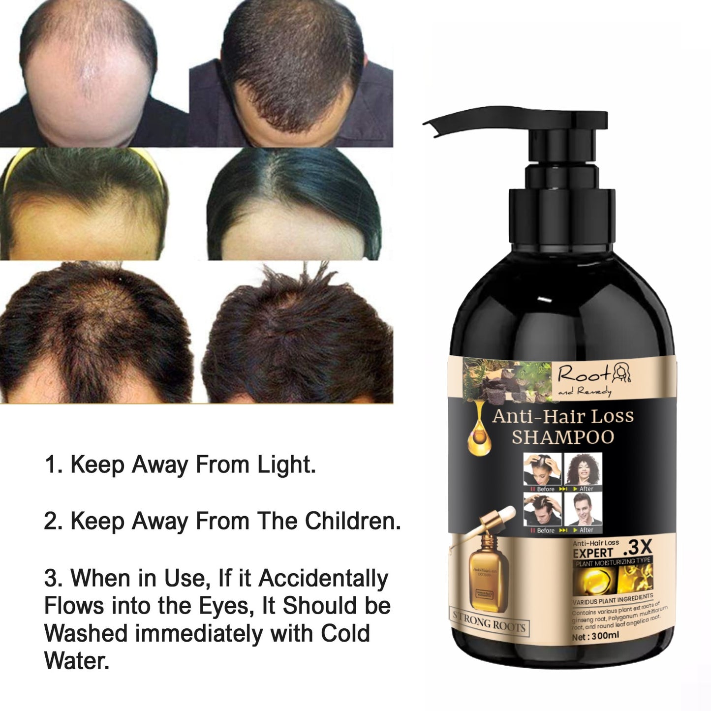 Root and Remedy Anti-hair Loss Shampoo & Conditioner 300ML