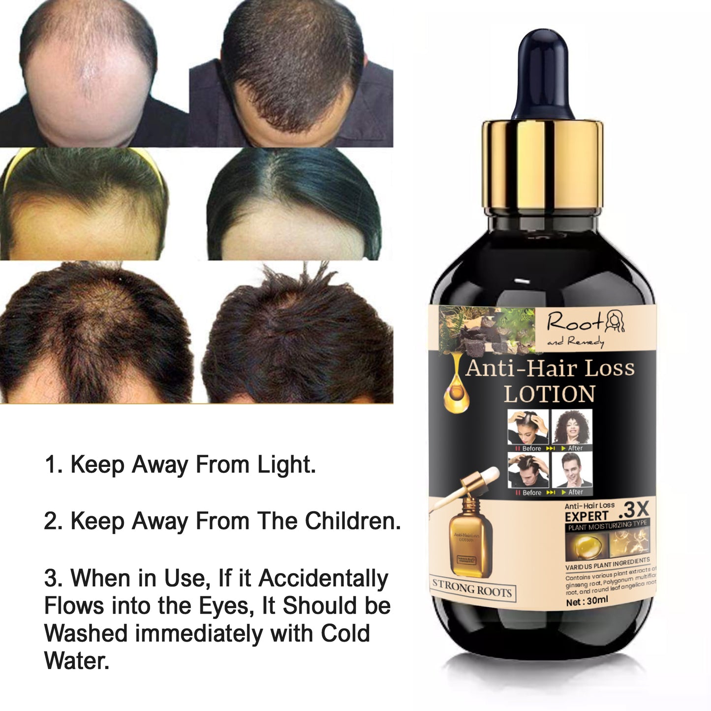 Root and Remedy Anti-hair Loss Lotion 30ml