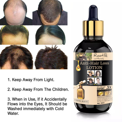 Root and Remedy Anti-hair Loss Lotion 30ml (Pack Of 2)