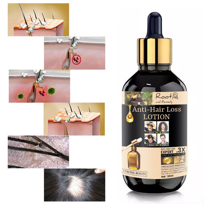 Root and Remedy Anti-hair Loss Lotion 30ml (Pack Of 2)