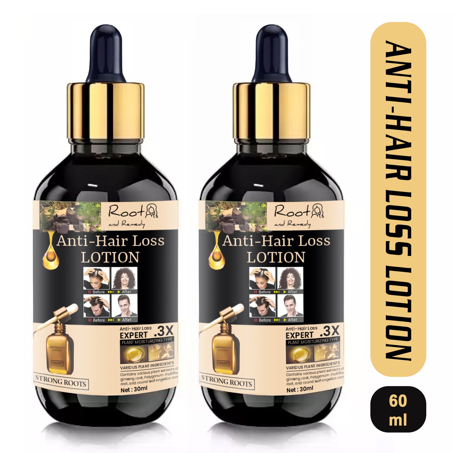 Root and Remedy Anti-hair Loss Lotion 30ml (Pack Of 2)