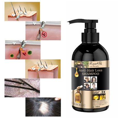 Root and Remedy Anti-hair Loss Shampoo & Lotion