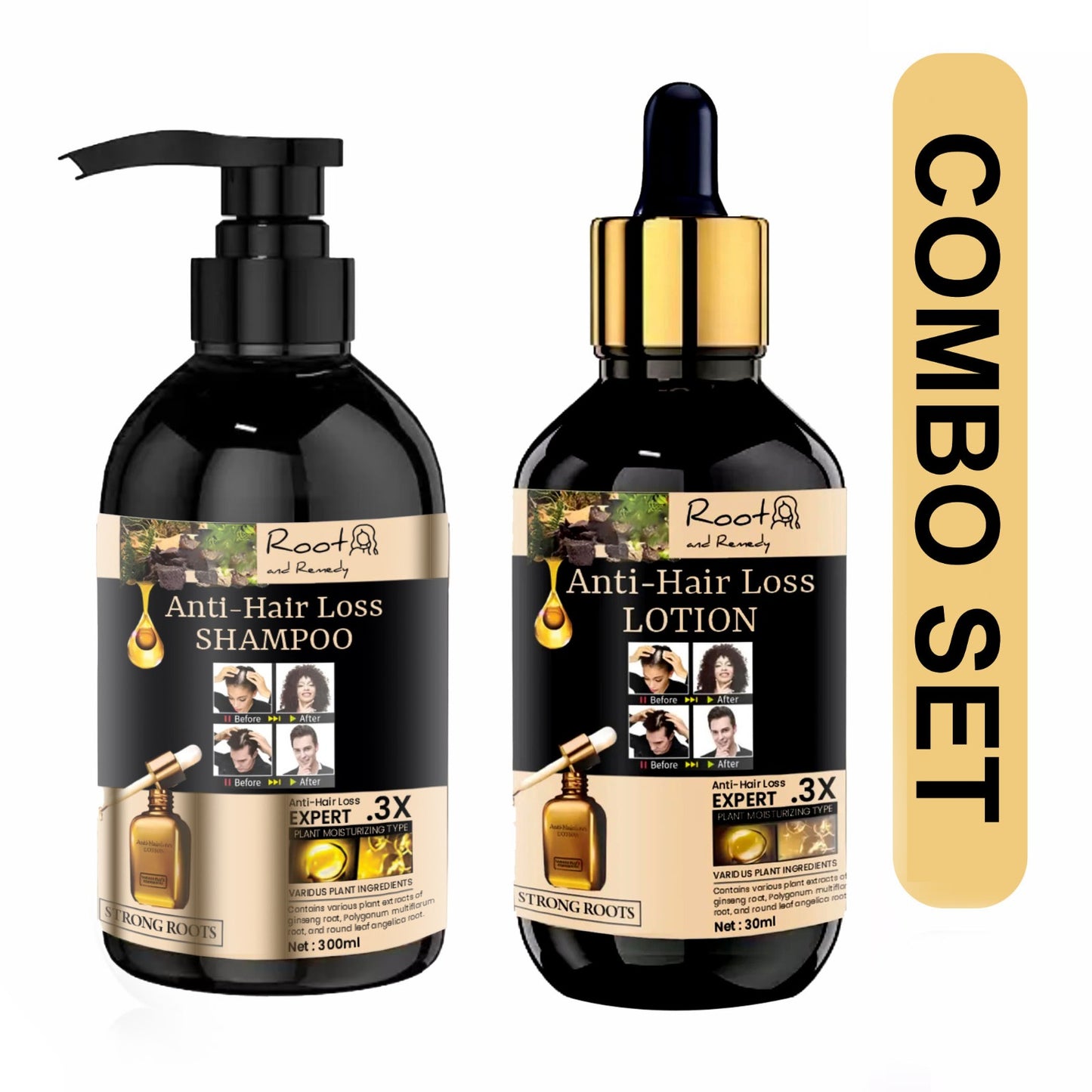 Root and Remedy Anti-hair Loss Shampoo & Lotion