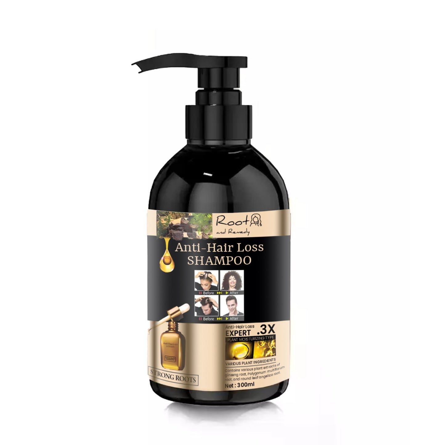 Root and Remedy Anti-hair Loss Shampoo 300ML