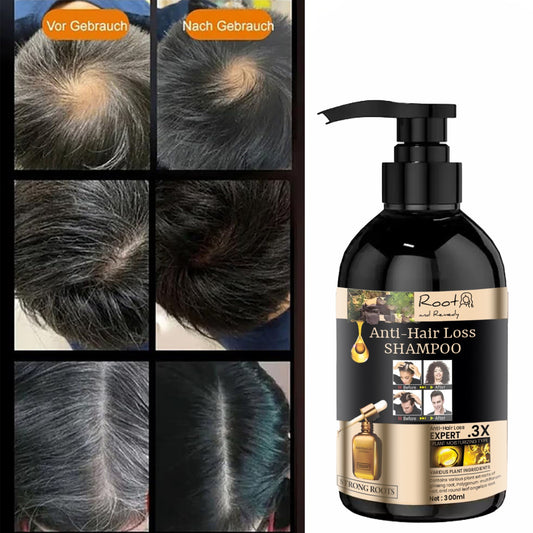 Root and Remedy Anti-hair Loss Shampoo & Conditioner 300ML